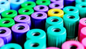 Several rows of blood test vials with colorful tops