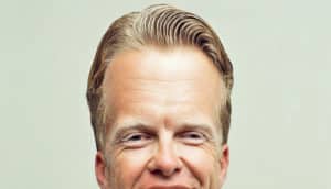 person's face altered to lengthen forehead