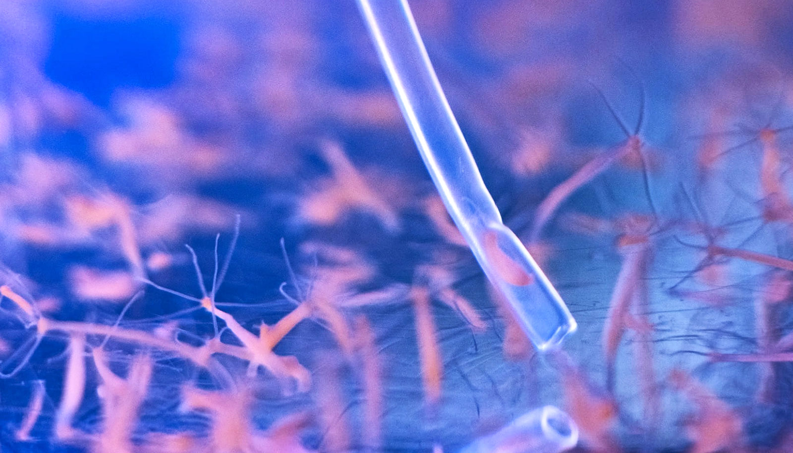 Inside look shows how 'headless' hydra react to a poke - Futurity Inside look shows how 'headless' hydra react to a poke - Futurity