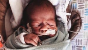 premature baby with canula