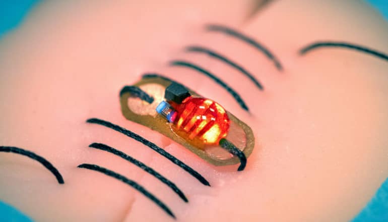 A sensor is connected to sutures woven through a piece of fake skin