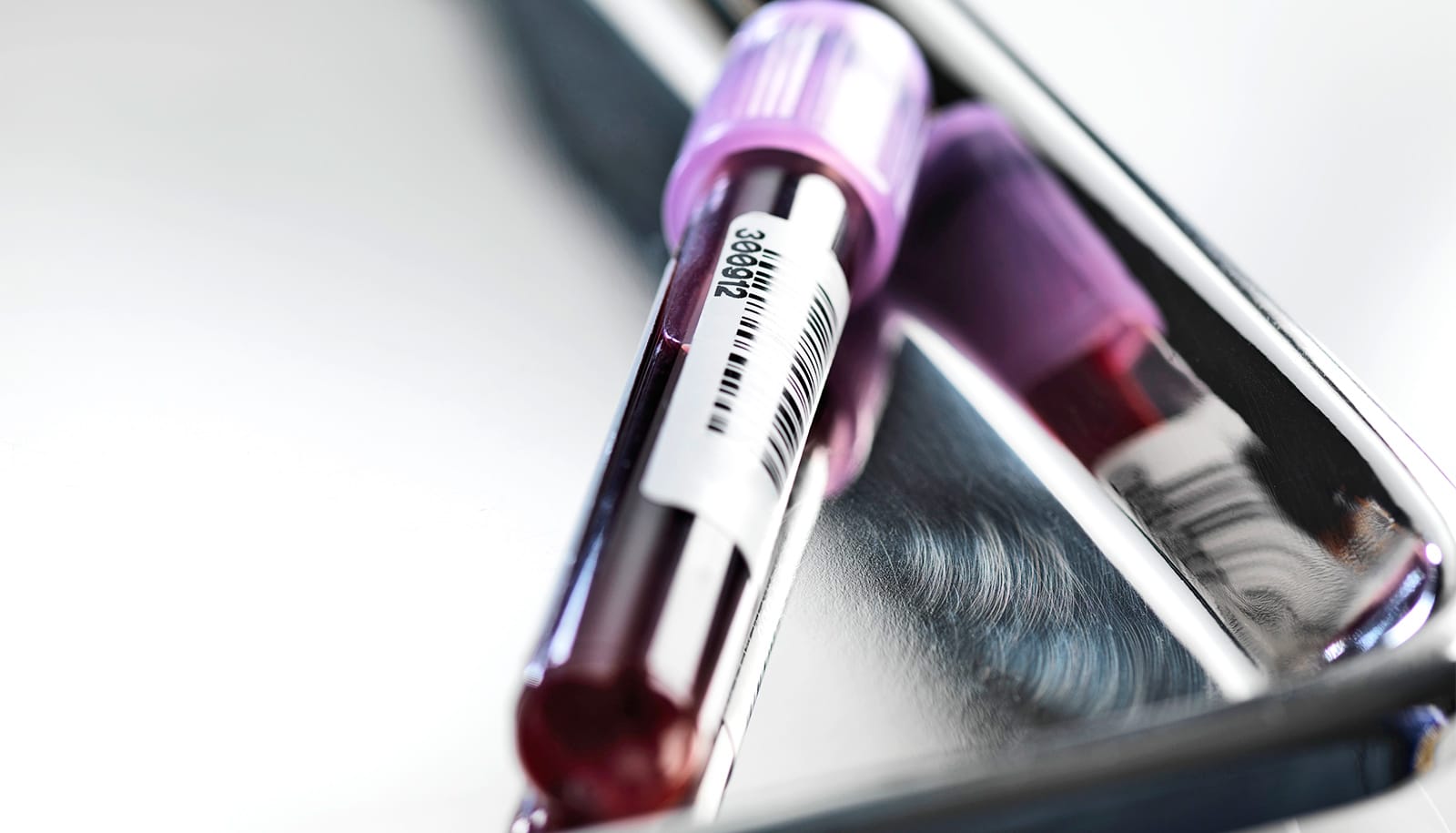 Race distorts  blood test results for Alzheimer’s disease