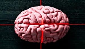 Red laser lights over a pink brain model sitting on wood