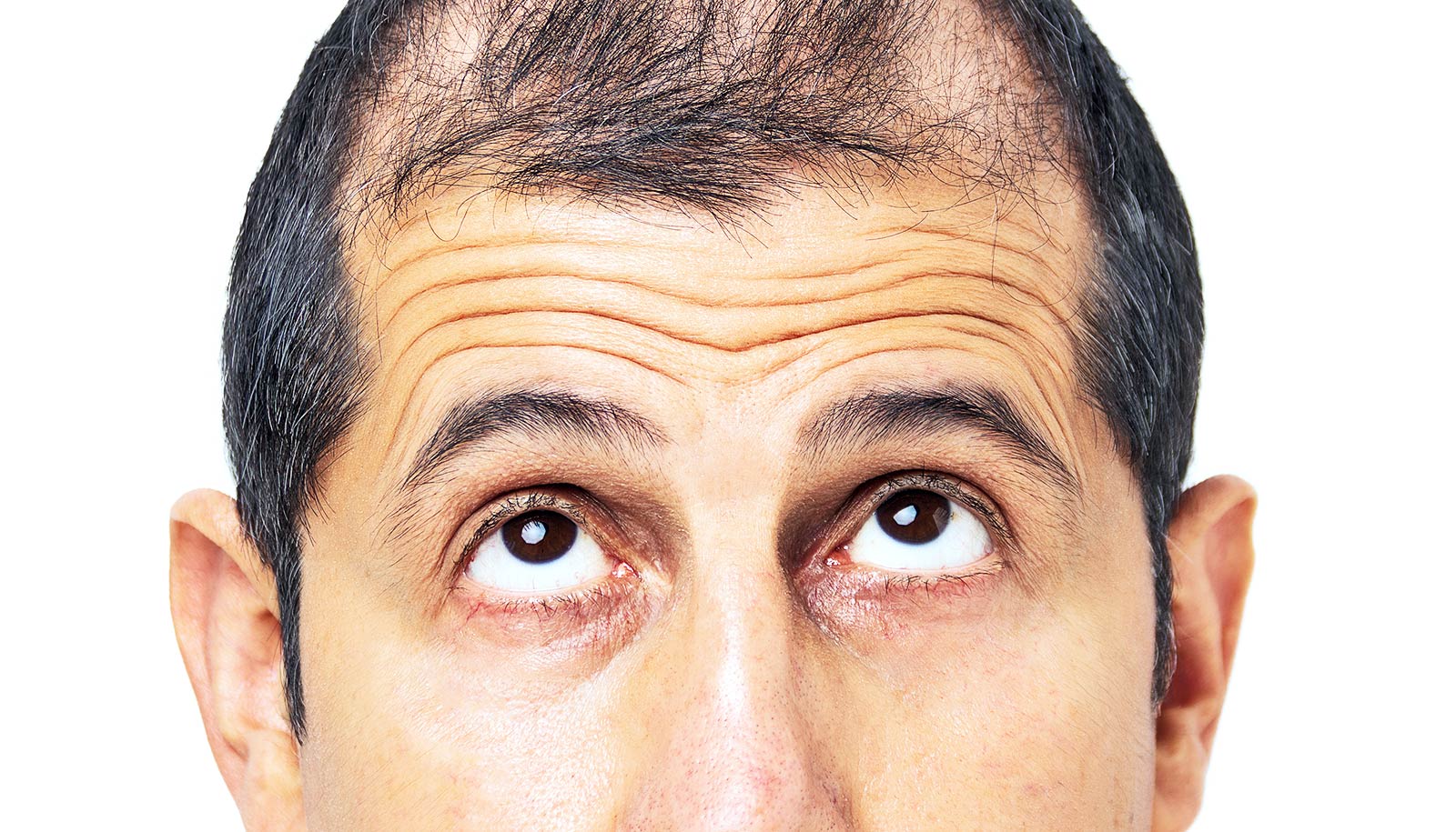SCUBE3 molecule may cause hair loss to grow again