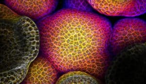 colorful blobby cells