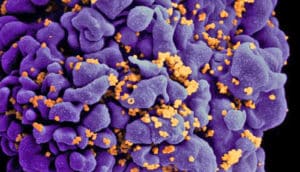 A human cell in purple with dots of orange showing HIV infection.