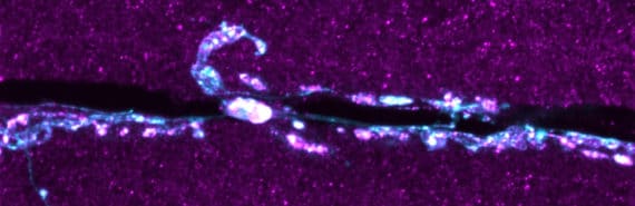 The neuromuscular junction appears as a thin band of black surrounded by bright pink to highlight the Tmep protein and blue.