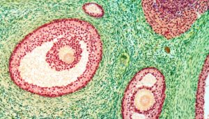 grainy red concentric circles on green