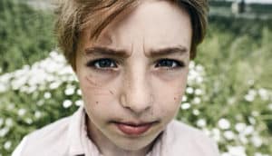 child with scrapes under eye looks intense and unhappy