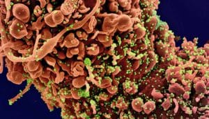 An image of a cell infected with SARS-CoV-2, shown in green.