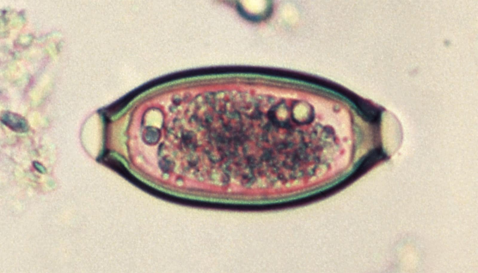 Eggs in Viking poop reveal whipworm genetics - Futurity