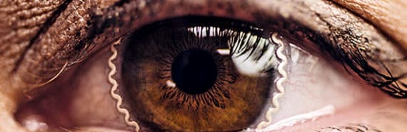 A close-up of an eye with the smart contact lens' electronics around the iris and pupil.