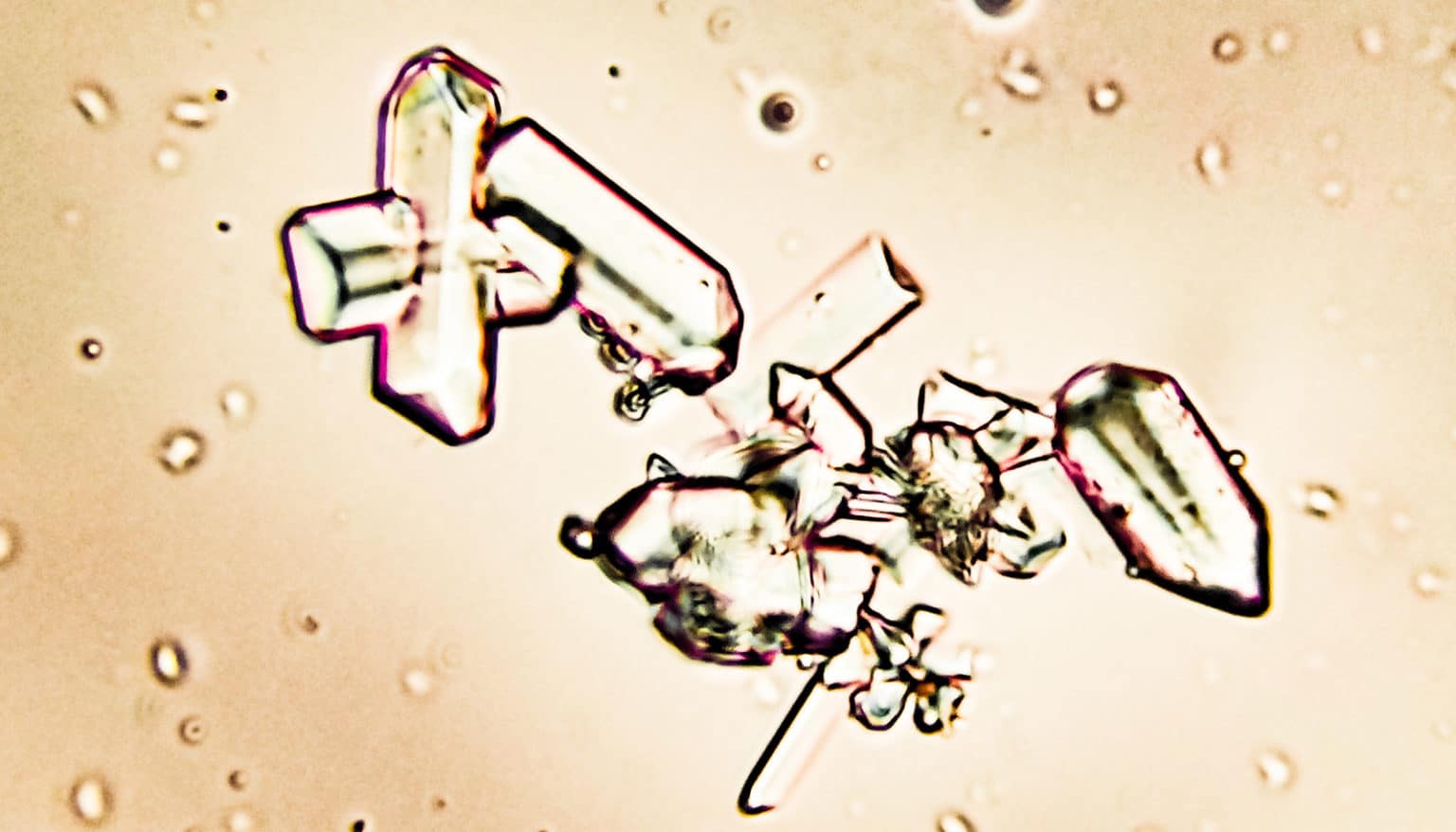 Struvite crystals in pet Urine under a microscope Futurity