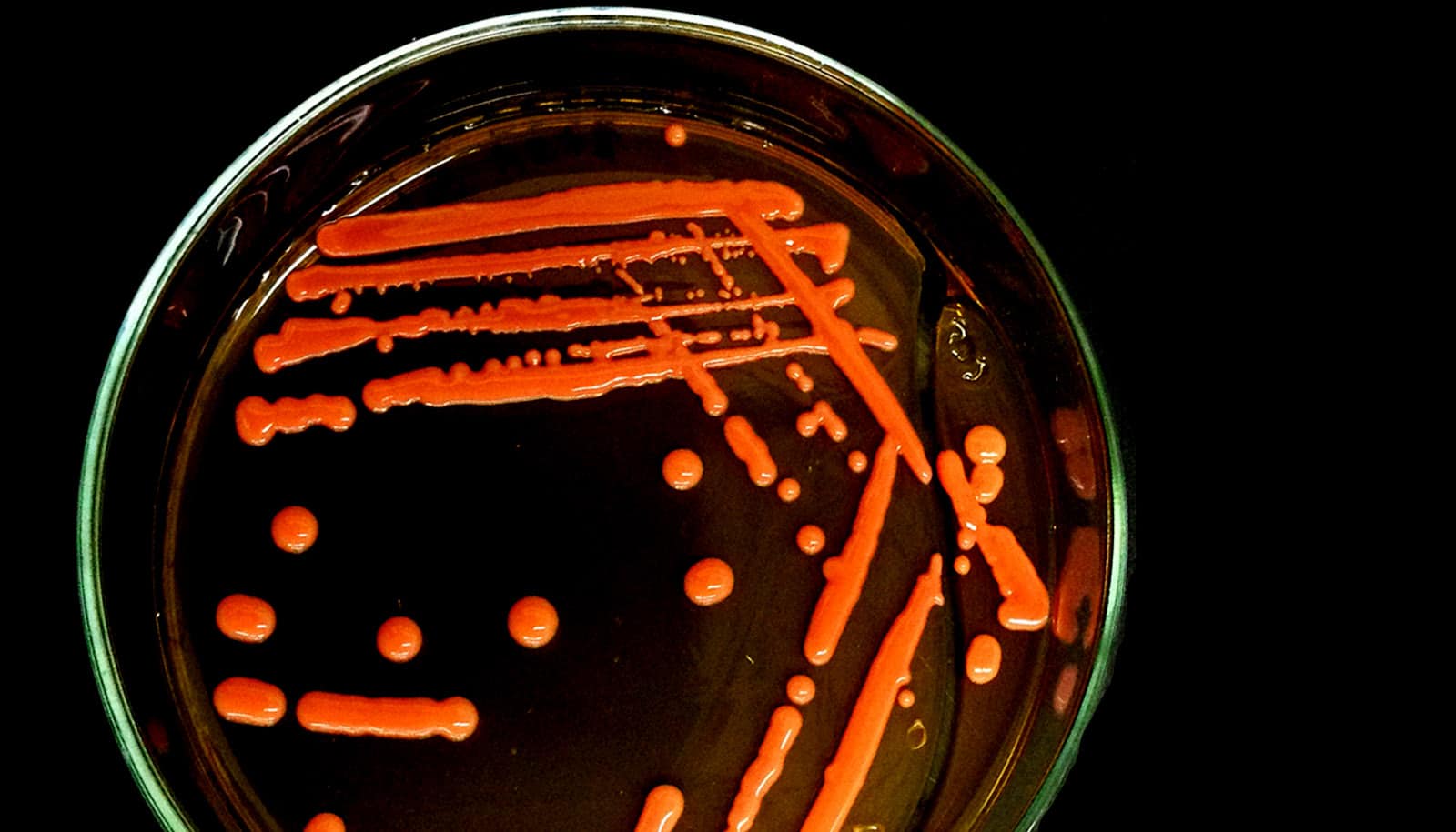 orange streaks in petri dish