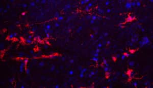 red and blue streaks on black