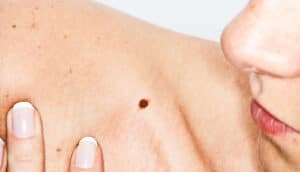 A woman looks at a mole on her clavicle.