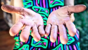A woman in a colorful dress holds her palms up.