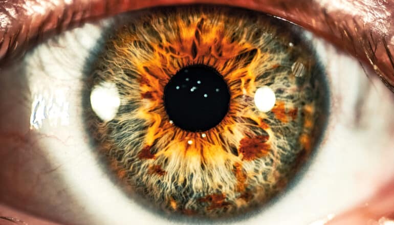 A close-up of a person's pupil.