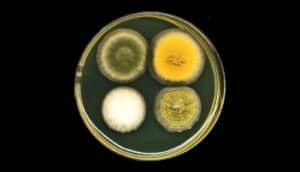 yellow, white, green circular colonies on petri dish