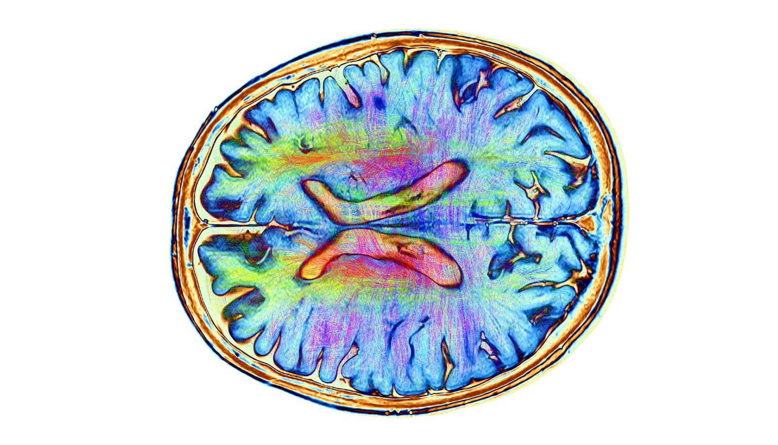 colorful brain scan