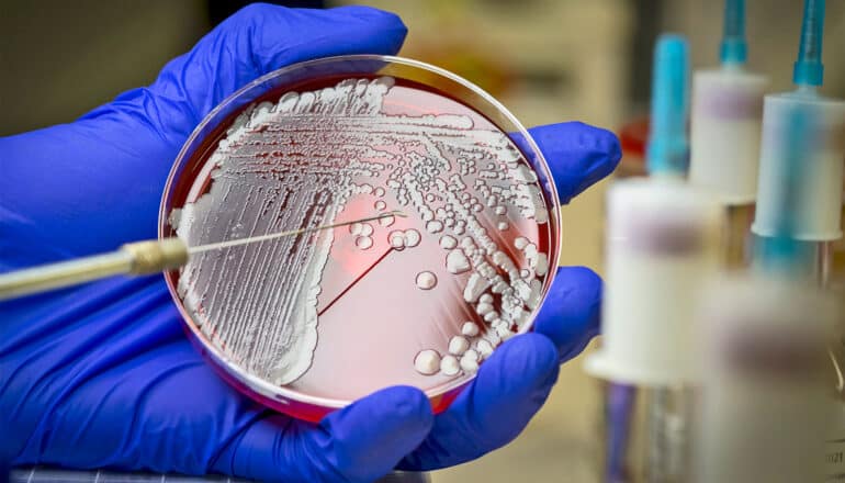 A person wearing a blue glove holds a petri dish with MRSA in it.