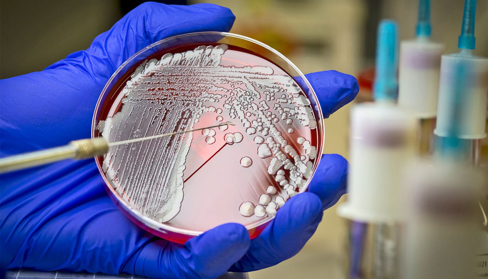 A person wearing a blue glove holds a petri dish with MRSA in it.