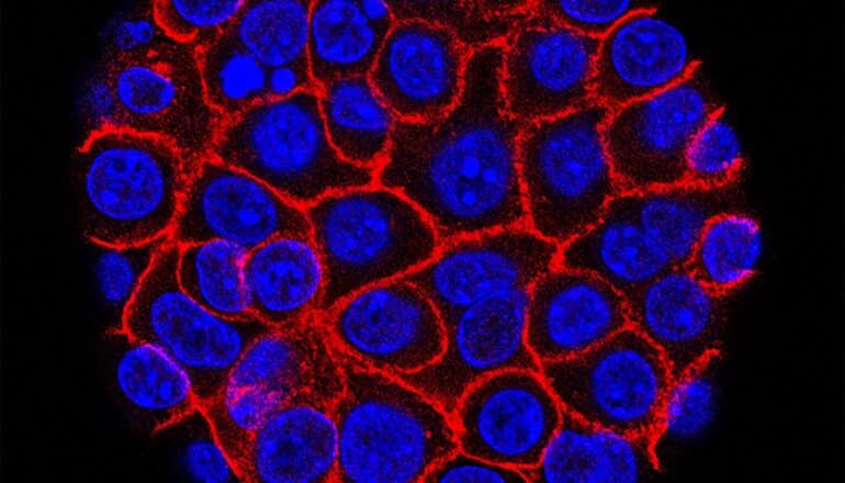 Pancreatic cancer cells (nuclei in blue) growing as a sphere encased in membranes (red).