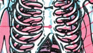 Grafitti of a ribcage inside a body in a style reminiscent of an x-ray.