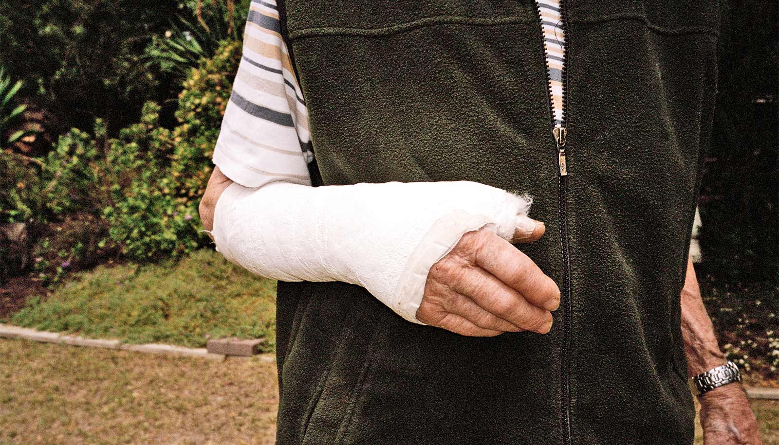 locking stem cell signal restores bone healing in aging mice