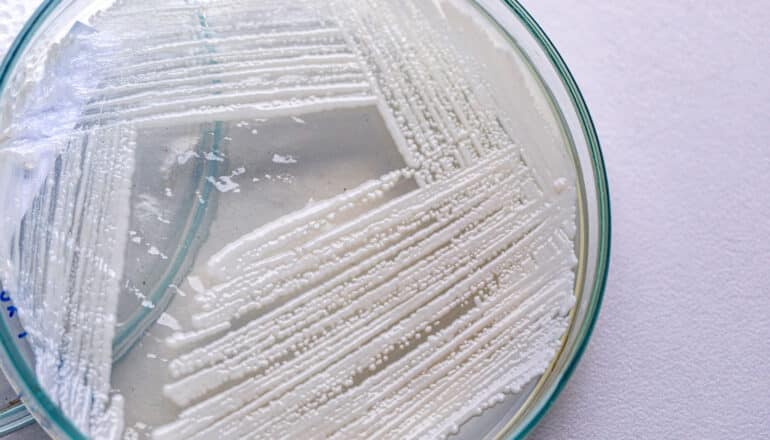 yeast grows in petri dish