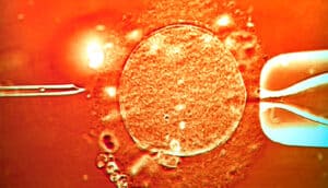 A shot of sperm being injected into an egg.