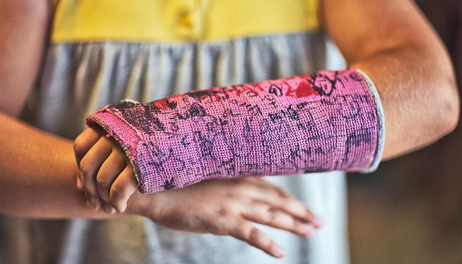 A child wears a purple cast covered in signatures and writing.