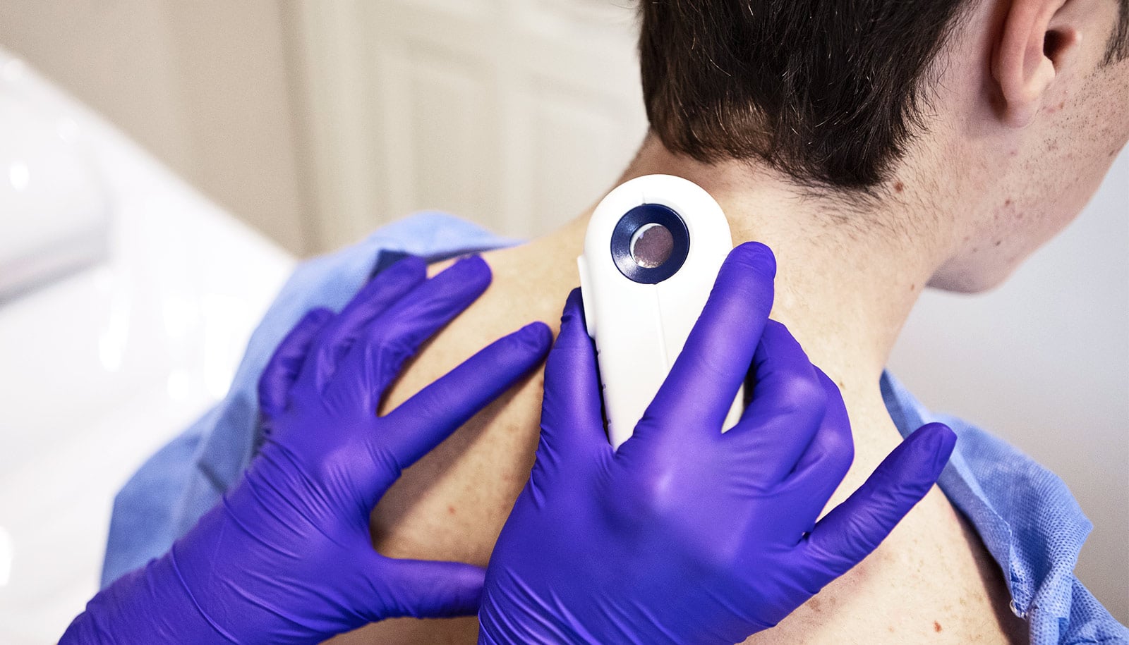 A doctor examines a patient's skin for melanoma.
