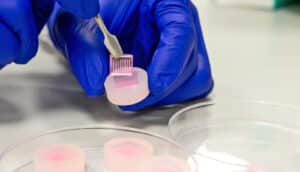 A researcher wearing blue gloves uses tweezers to hold up a pink, square microneedle patch.