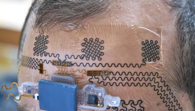 A researcher wears the electronic tattoo on their forehead. The tattoo looks like a clear plastic layer embedded with black electronics.