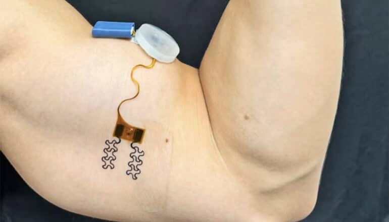 A person wears the new sensor, which consists of a plastic-looking piece connected to electronics on the skin via a wire, on his bicep.