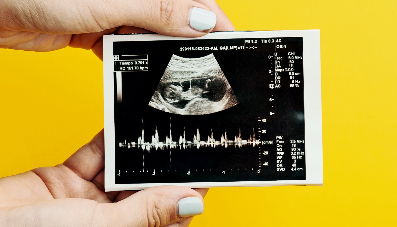 Parents' ideas about their baby can start at an ultrasound
