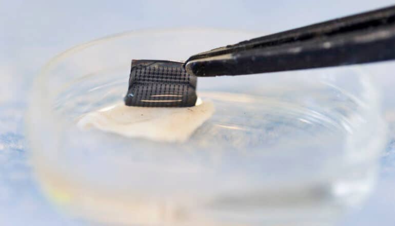 Patch could allow you to test for skin cancer at home