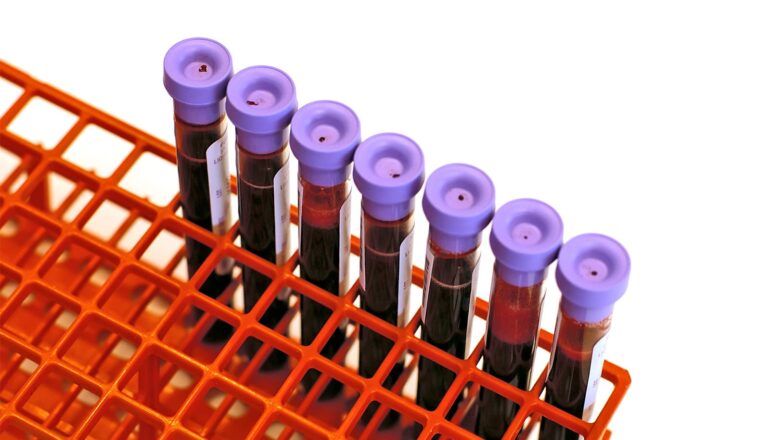 A row of blood sample vials with purple caps sit in a red vial holder.
