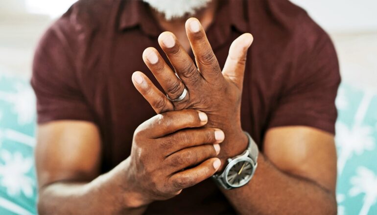 A man holds one hand with the other in pain.
