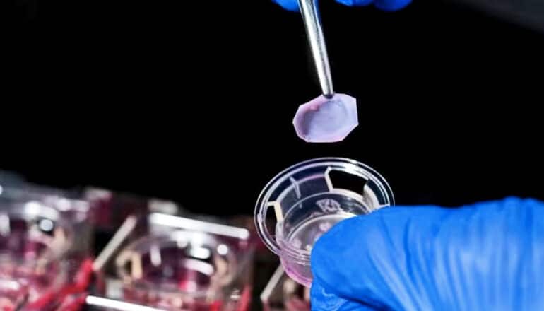 A researcher wearing blue gloves picks up a small piece of lab-grown skin with a pair of tweezers.