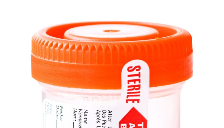 A urine test cup with a bright orange lid.