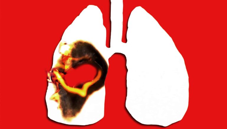 Paper cut into the shape of human lungs burns on one side.