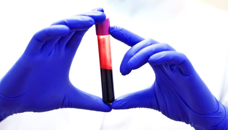 A person wearing purple gloves holds a vial of blood.