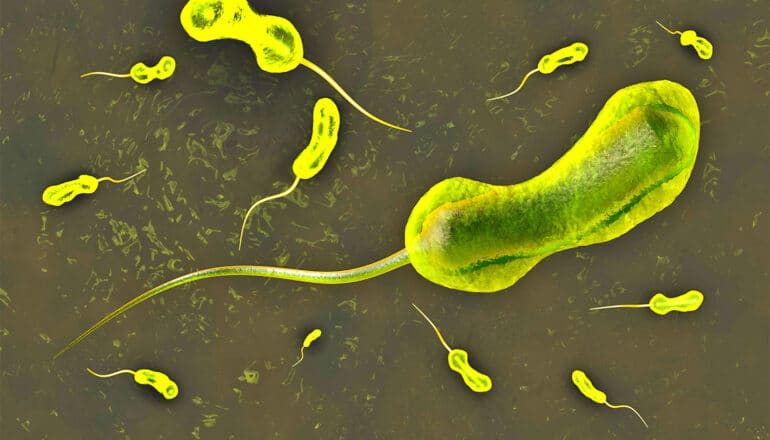 An illustration of cholera bacteria with long tails.