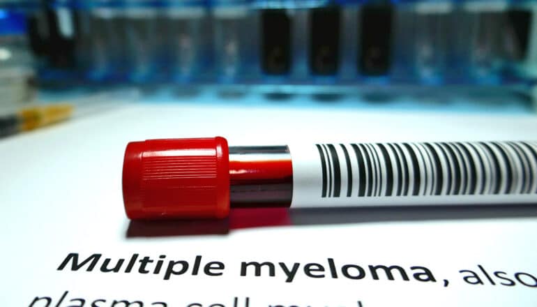 A vial of blood on a table sits on a paper with the words "multiple myeloma" on it.