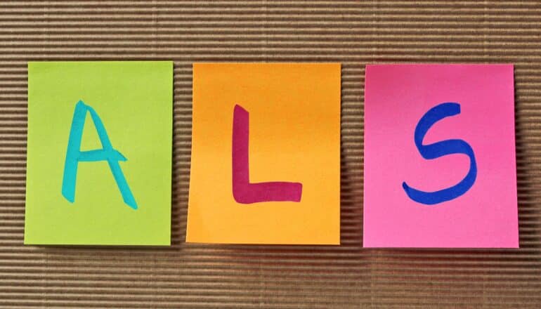 Three sticky notes with "A," "L," and "S" written on them.