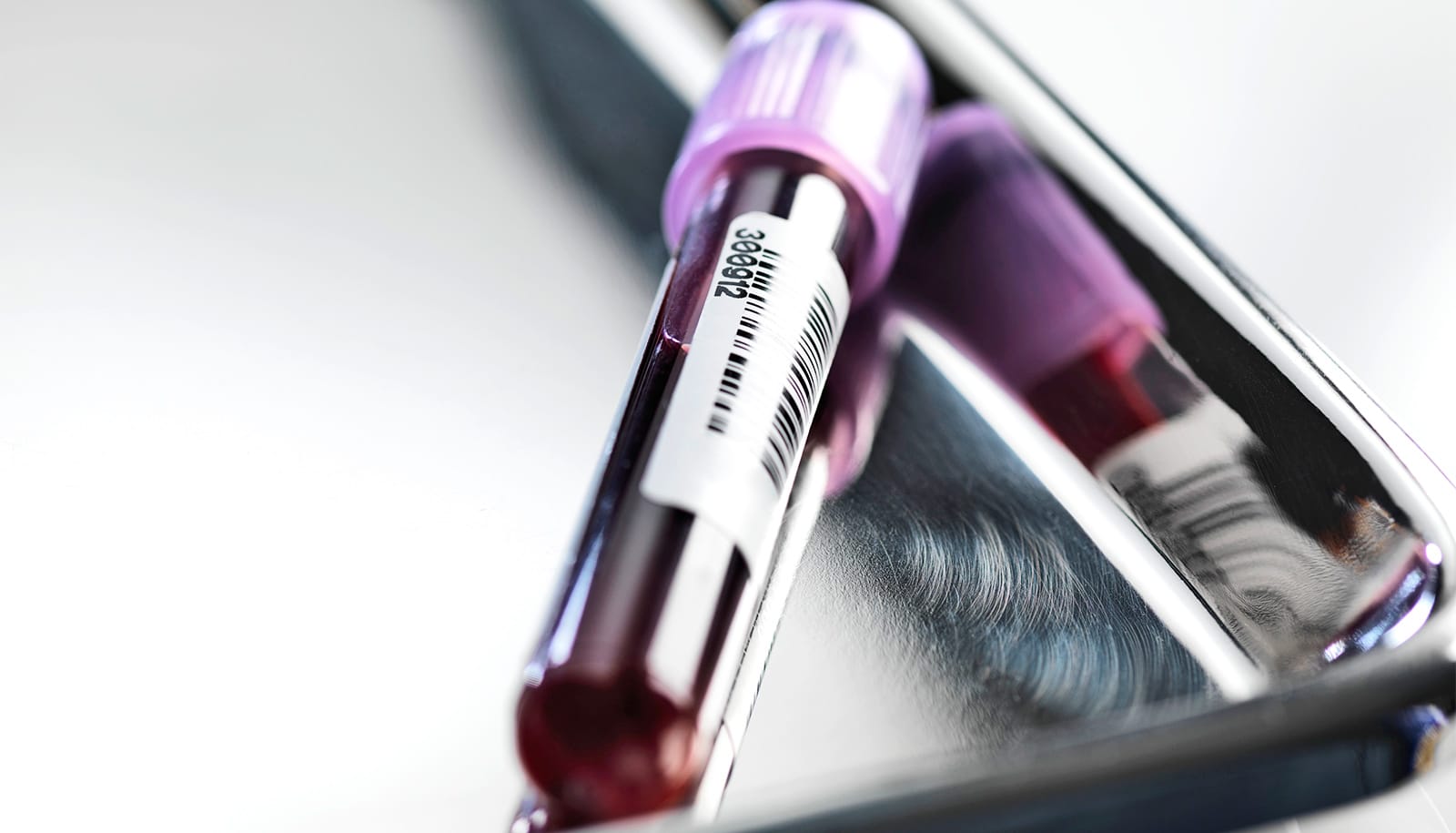 Blood Tests Predict Lymphoma Treatment Response in Dogs – and Humans