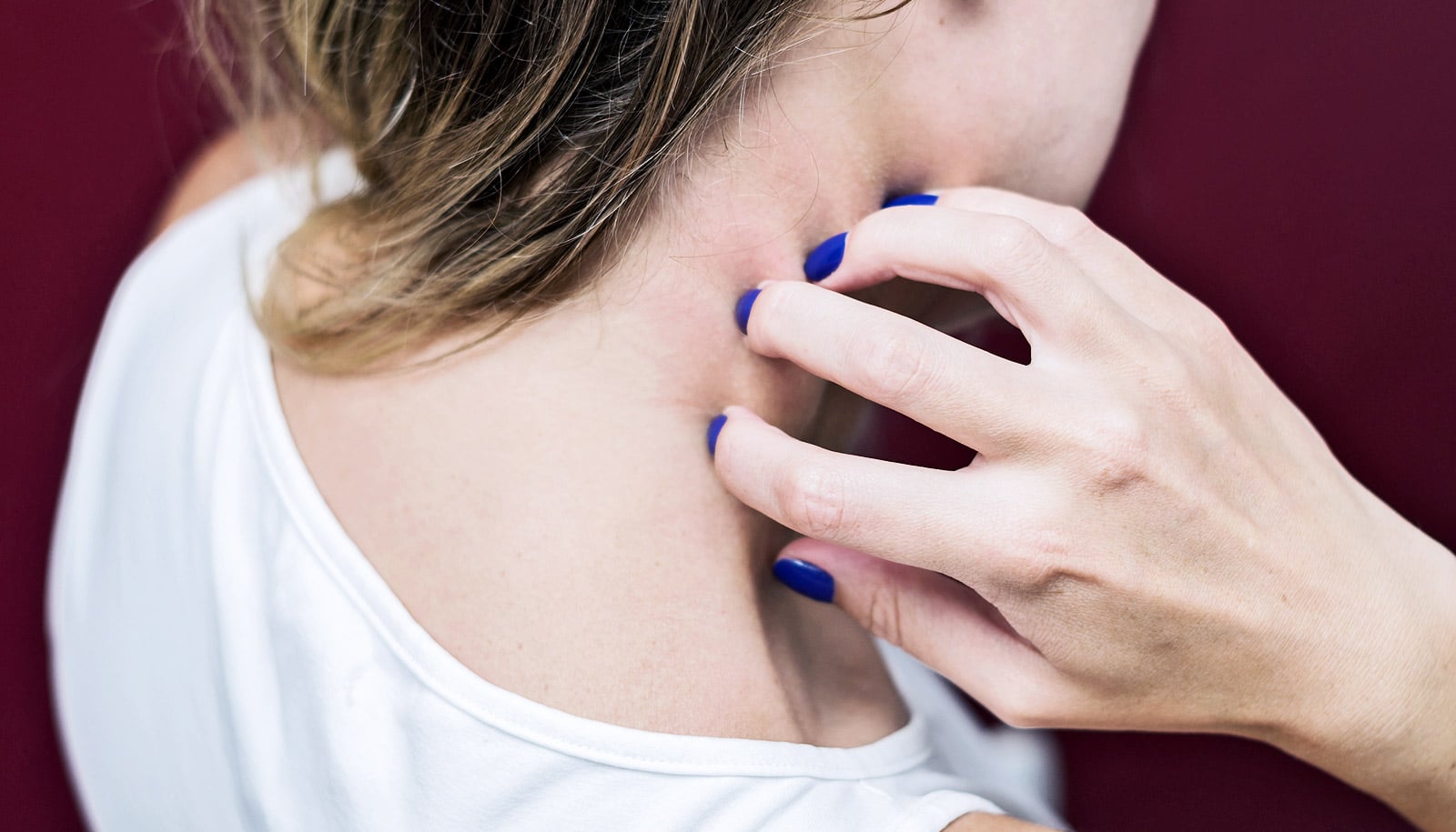 Does chronic itching set the brain up for depression?