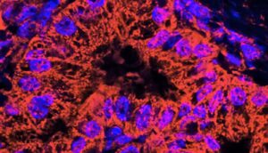Microscopic image of mitochondrial stained pancreatic cancer cells.